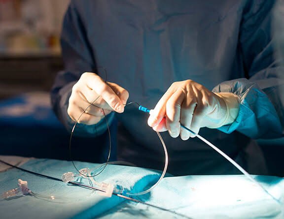 Deep Vein Thrombosis Treatment