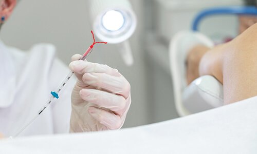 Intrauterine Insemination IUI Treatment